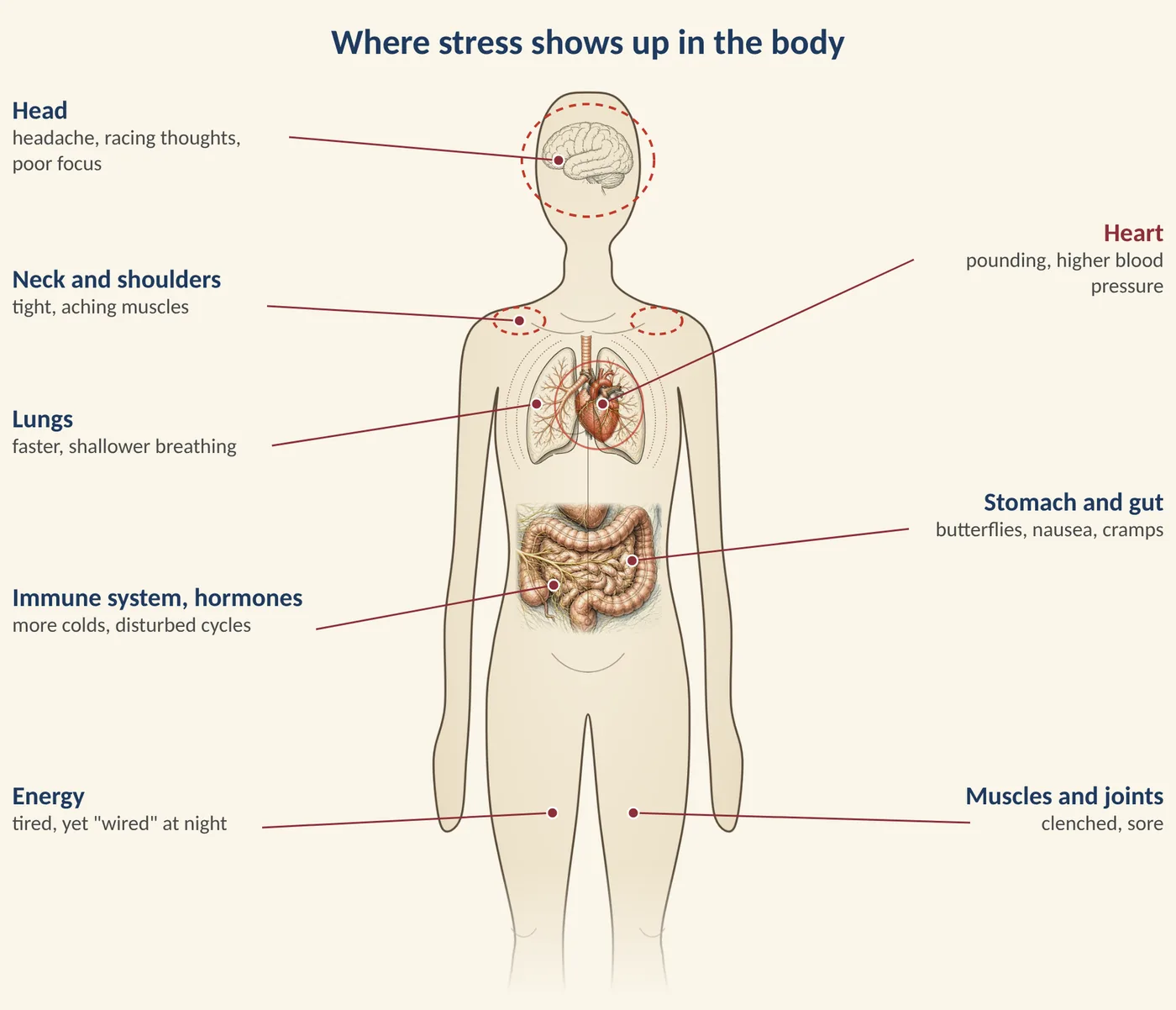 Figure 7.3 Where stress shows up in the body. (Illustration created with AI tools.)